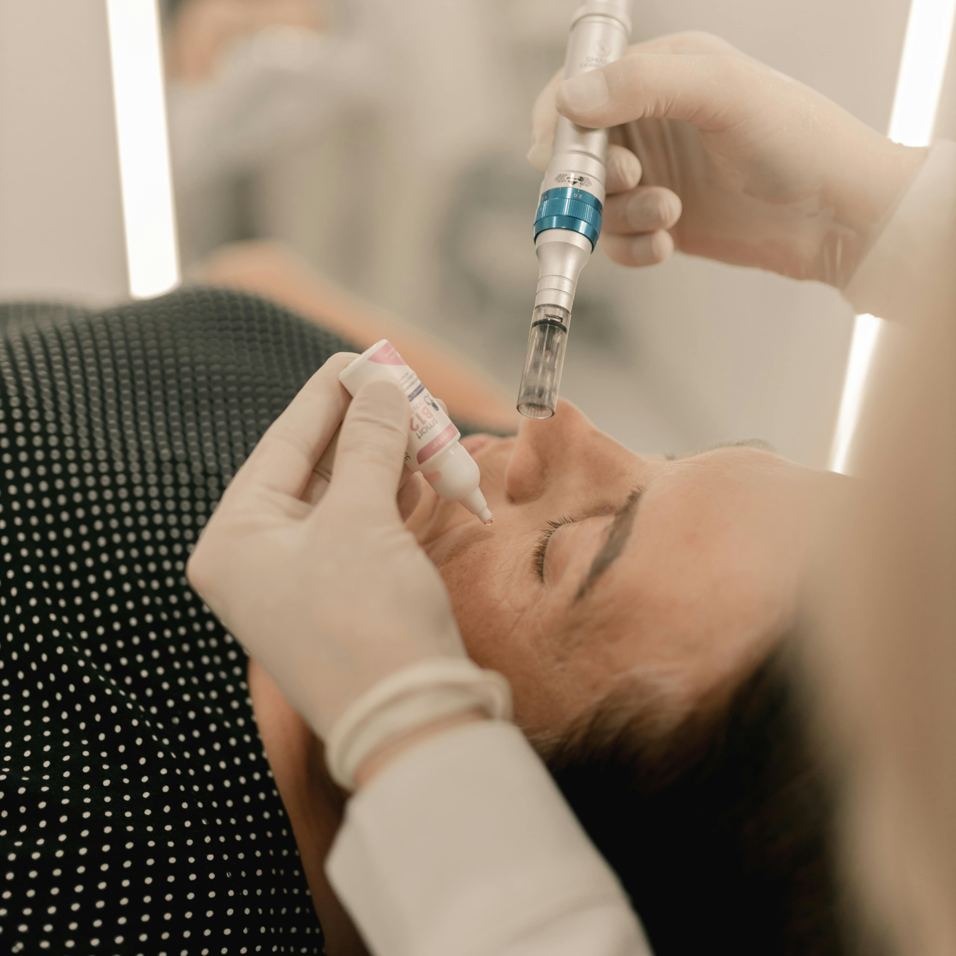 microneedling