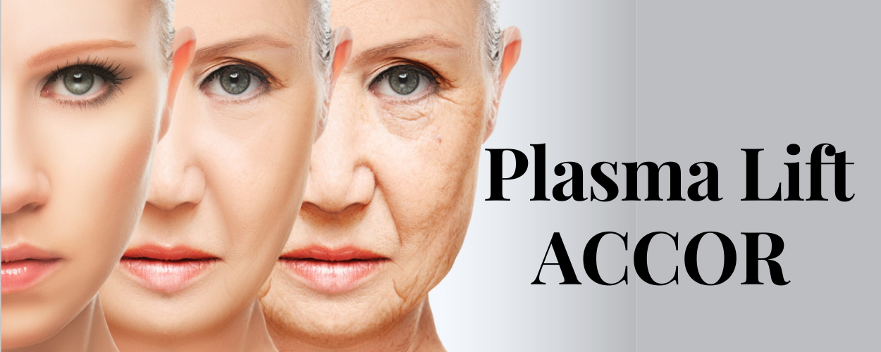 Plasma lift (1) Plasma lift (1)