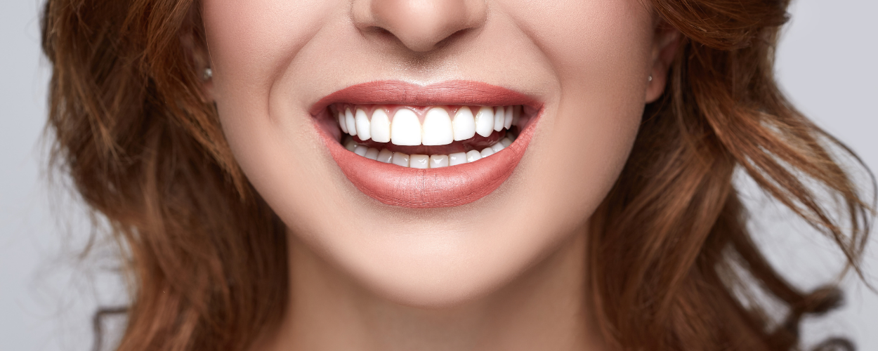 Teeth whitening Teeth whitening